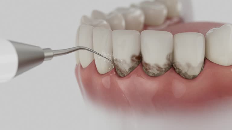Reliable Dental Implants contractor in Brooklawn, NJ by Smile Center Dentistry